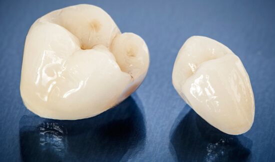 Veneers